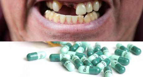 Japanese researchers are developing a drug to make teeth regrow